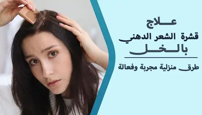 علاج قشرة الشعر الدهني بالخل بالطريقة الصحيحة 1 علاج قشرة الشعر الدهني بالخل بالطريقة الصحيحة