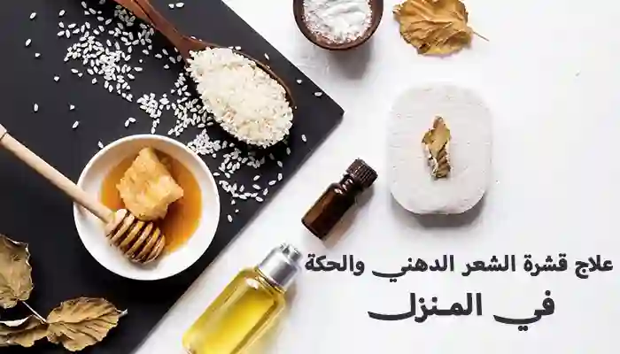 علاج قشرة الشعر الدهني والحكة في المنزل 1 علاج قشرة الشعر الدهني والحكة في المنزل