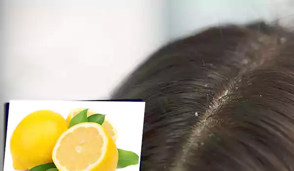 فوائد الليمون لفروة الرأس