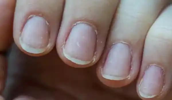 كيفية العناية بالأظافر وتطويلها بسرعة - 3 وصفات طبيعية أسباب ضعف الأظافر - مكتوبة