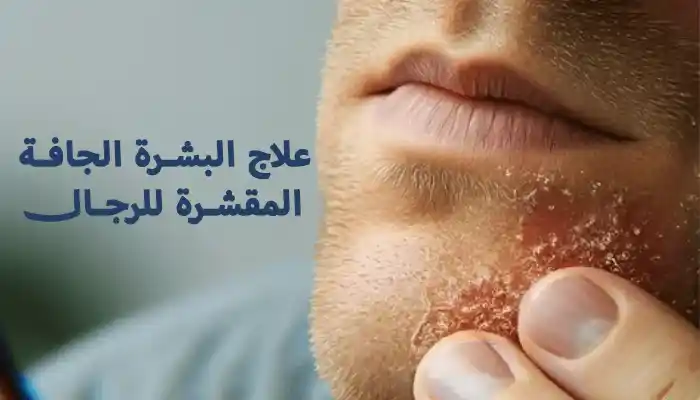 علاج البشرة الجافة المقشرة للرجال نهائياً 1 علاج البشرة الجافة المقشرة للرجال نهائياً