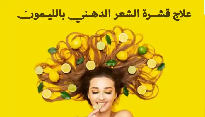 علاج قشرة الشعر الدهني بالليمون من أول مرة 1 علاج قشرة الشعر الدهني بالليمون من أول مرة