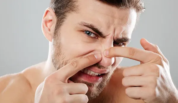 طريقة تنظيف البشرة الدهنية من الرؤوس السوداء في 10 دقائق 5 نصائح إضافية لمعالجة الرؤوس السوداء