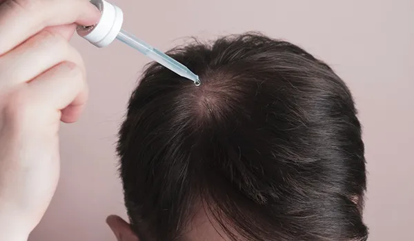علاج تساقط الشعر بـ 60 حل سحري طبيعي حسب نوع شعرك! 5 طرق لوقف تساقط الشعر