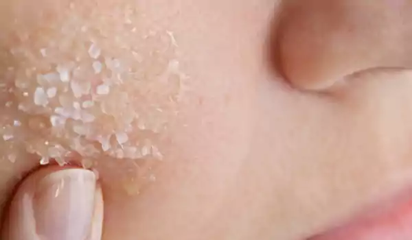 تقشير البشرة الدهنية بالسكر - مكتوبة