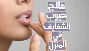 علاج حبوب الشفايف في المنزل