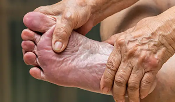 المشاكل المسببة لأمراض القدم مع علاجها