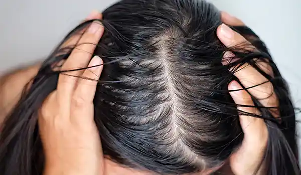 أفضل 19 ماسك للشعر طبيعي منزلي حسب النوع ماسكات-طبيعية-للشعر-الدهني-مكتوبة.webp