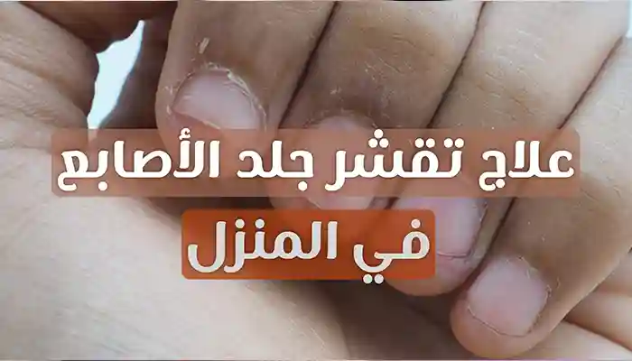 علاج تقشر جلد الأصابع