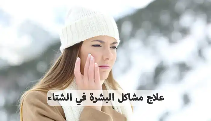 علاج مشاكل البشرة في الشتاء 10 نصائح للحفاظ على النعومة علاج مشاكل البشرة في الشتاء