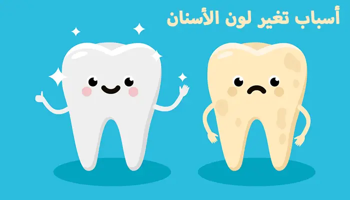 أسباب تغير لون الأسنان وتبييضها طبيعياً بالمنزل