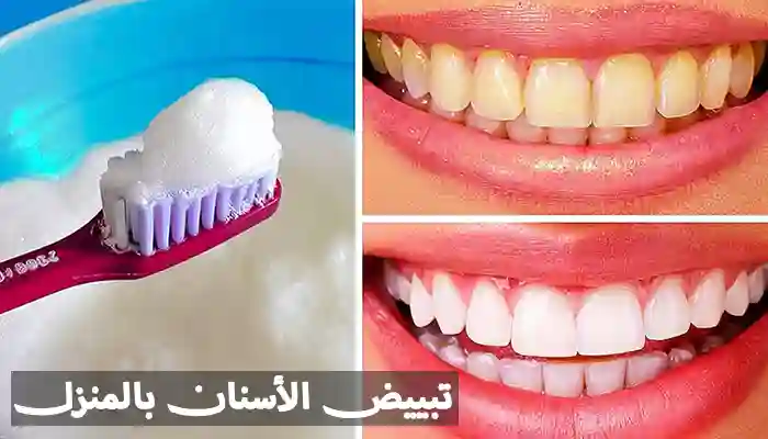 كيفية تبييض الأسنان في المنزل