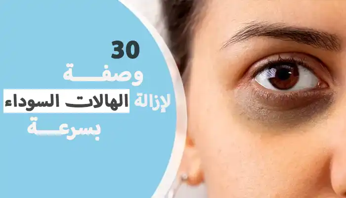 أفضل 30 وصفة لإزالة الهالات السوداء بسرعة عن تجربة 1 أفضل 30 وصفة لإزالة الهالات السوداء بسرعة عن تجربة