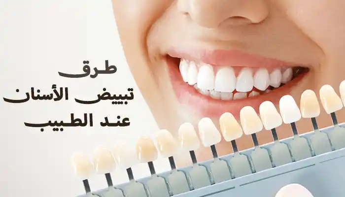 أفضل طرق تبييض الأسنان عند الطبيب 1 أفضل طرق تبييض الأسنان عند الطبيب