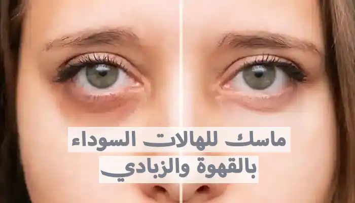 ماسك للهالات السوداء بالقهوة والزبادي | وصفة طبيعية مجربة 1 ماسك للهالات السوداء بالقهوة والزبادي | وصفة طبيعية مجربة