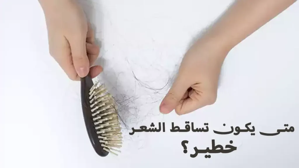 متى يكون تساقط الشعر خطير؟ احذر قبل الصلع