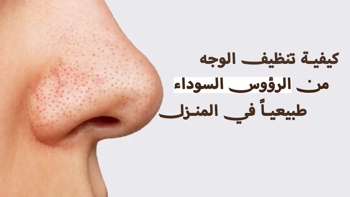 تنظيف الوجه من الرؤوس السوداء نهائياً بوصفات منزلية تنظيف الوجه من الرؤوس السوداء نهائياً بوصفات منزلية